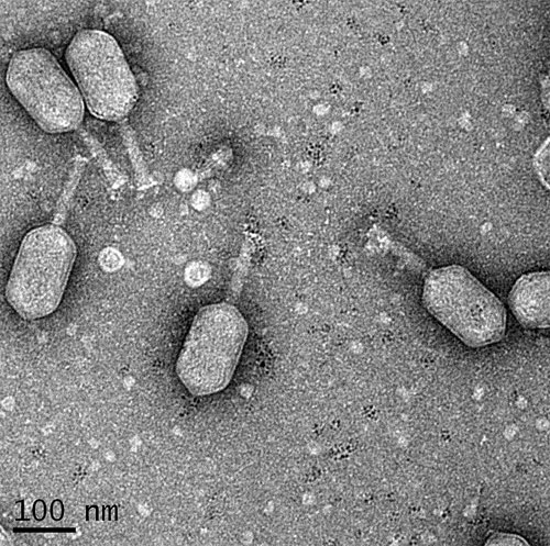 Бактериофаг ϕpp2 патогенных вибрионов V. parahaemolyticus  и V. alginolyticus. Фото, фотография 